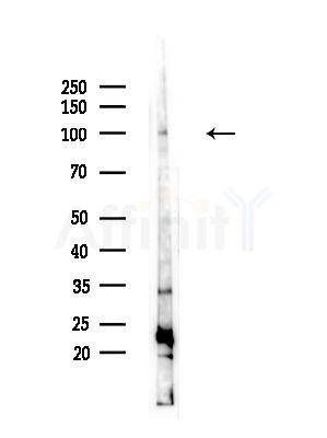 LRP12 Antibody - Western blot analysis of lysates from COLO(UV,30min treatment), using LRP12 Antibody at 1/1000 dilution.