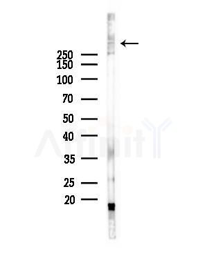 LRP1B Antibody - Western blot analysis of lysates from HepG2 cells(starvation,24h treatment), using LRP1B Antibody at 1/1000 dilution.