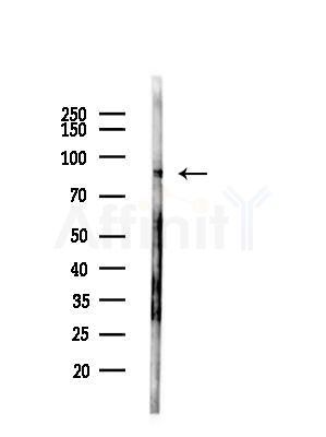 MED15 Antibody - Western blot analysis of lysates from COLO205 cells(UV,30min treatment), using MED15 Antibody at 1/1000 dilution.
