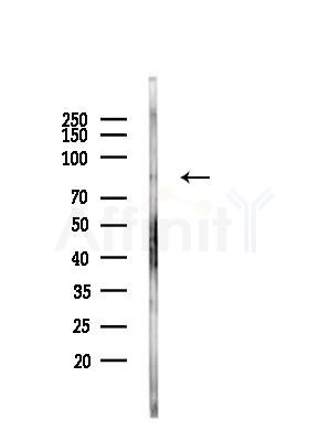 MED15 Antibody - Western blot analysis of lysates from LoVo cells(heat-shock,45min treatment), using MED15 Antibody at 1/1000 dilution.