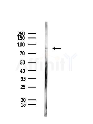 MED15 Antibody - Western blot analysis of lysates from Rat testis, using MED15 Antibody at 1/1000 dilution.