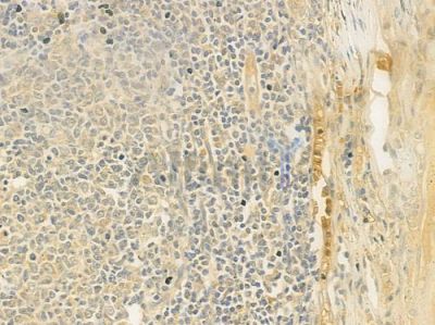 MED15 Antibody - DF9613 at 1/100 staining human normal tonsil tissue by IHC-P.
