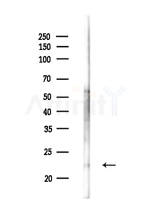 MED22 Antibody - Western blot analysis of lysates from Mouse liver, using MED22 Antibody at 1/1000 dilution.