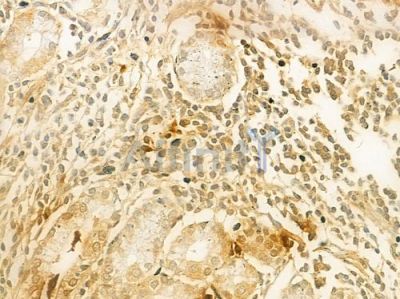 MED28 Antibody - DF9615 at 1/100 staining human normal gastric tissue by IHC-P.