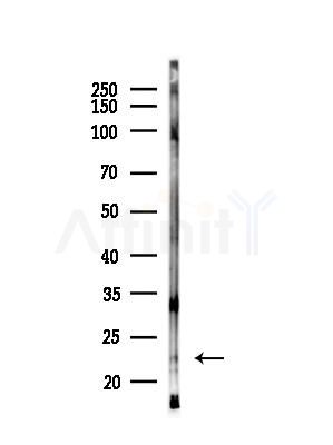 MED29 Antibody - Western blot analysis of lysates from EC304 cells(heat-shock,45min treatment), using MED29 Antibody at 1/1000 dilution.