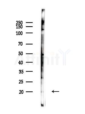 MRAP Antibody - Western blot analysis of lysates from HUVEC cells(LPS,4h treatment), using MRAP Antibody at 1/1000 dilution.