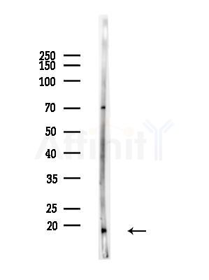 MRPL23 Antibody - Western blot analysis of lysates from COLO205 cells(heat-shock,45min treatment), using MRPL23 Antibody at 1/1000 dilution.