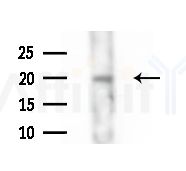 IMMP1L Antibody - Western blot analysis of extracts from LoVo cells(heat-shock,45min treatment), using IMMP1L Antibody at 1/1000 dilution.