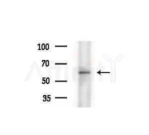 C3orf31 Antibody - Western blot analysis of extracts from various samples, using C3orf31 Antibody at 1/1000 dilution.