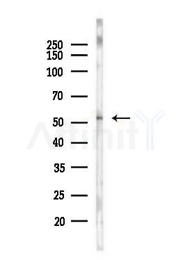 C3orf31 Antibody - Western blot analysis of lysates from PC12 cells(LPS, 4h treatment), using C3orf31 Antibody at 1/1000 dilution.