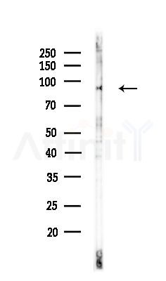 MPHOSPH8 Antibody - Western blot analysis of lysates from COLO205 cells(UV,30min treatment), using MPHOSPH8 Antibody at 1/1000 dilution.