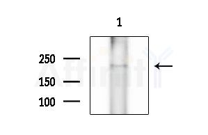 MUC4 Antibody - Western blot analysis of extracts from B16F10-LUC cells(heat-shock treatment), using MUC4 Antibody at 1/1000 dilution.