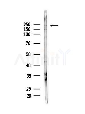 MUC4 Antibody - Western blot analysis of lysates from B16F10-LUC cells(heat-shock,45min treatment), using MUC4 Antibody at 1/1000 dilution.