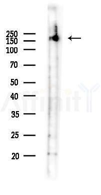 MRP6 Antibody - Western blot analysis of lysates from Mouse liver, using MRP6 Antibody at 1/1000 dilution.