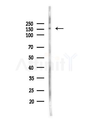 MEGF6 Antibody - Western blot analysis of lysates from Hela cells(heat-shock,45min treatment), using MEGF6 Antibody at 1/1000 dilution.