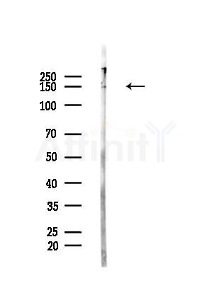 MYO6 Antibody - Western blot analysis of lysates from B16F10-HUC(heat-shock,45min treatment), using MYO6 Antibody at 1/1000 dilution.