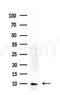 NDUFB3 Antibody - Western blot analysis of extracts from Rat brain, using NDUFB3 Antibody at 1/1000 dilution.