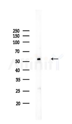 NDUFV1 Antibody - Western blot analysis of lysates from COLO205 cells, using NDUFV1 Antibody at 1/1000 dilution.