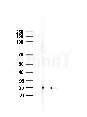 NDUFS8 Antibody - Western blot analysis of lysates from Mouse testis, using NDUFS8 Antibody at 1/1000 dilution.
