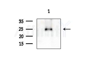 NRSN2 Antibody - Western blot analysis of extracts from HUVEC cells, using NRSN2 Antibody at 1/1000 dilution.