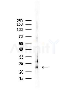 NRSN2 Antibody - Western blot analysis of lysates from HUVEC cells, using NRSN2 Antibody at 1/1000 dilution.