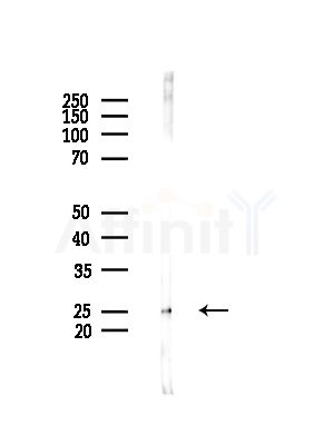 NCALD Antibody - Western blot analysis of lysates from Hela cells(heat-shock,45min treatment), using NCALD Antibody at 1/1000 dilution.