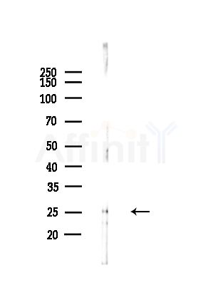NCALD Antibody - Western blot analysis of lysates from A375 cells(LPS,4h treatment), using NCALD Antibody at 1/1000 dilution.