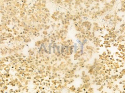 SCG5 Antibody - DF9688 at 1/100 staining human pituitary adenoma by IHC-P.