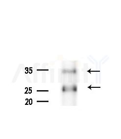 NEUROD4 Antibody - Western blot analysis of extracts from Mouse liver, using NEUROD4 Antibody at 1/1000 dilution.