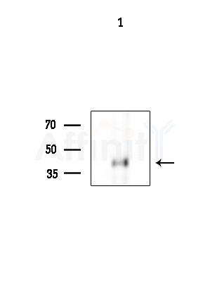 NEUROD4 Antibody - Western blot analysis of extracts from B16F10-LUC cells(UV, 30min treatment), using NEUROD4 Antibody at 1/1000 dilution.