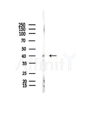 NEUROD4 Antibody - Western blot analysis of lysates from B16F10-LUC cells(UV,30min treatment), using NEUROD4 Antibody at 1/1000 dilution.