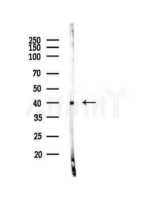 NEUROD4 Antibody - Western blot analysis of lysates from MDA-MB-231 cells(heat-shock,45min treatment), using NEUROD4 Antibody at 1/1000 dilution.