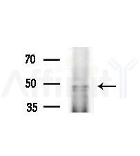 CHRNB3 Antibody - Western blot analysis of extracts from various samples, using CHRNB3 Antibody at 1/1000 dilution.