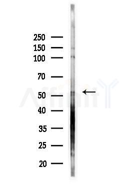CHRNB3 Antibody - Western blot analysis of lysates from HepG2 cells(LPS, 4h treatment), using CHRNB3 Antibody at 1/1000 dilution.