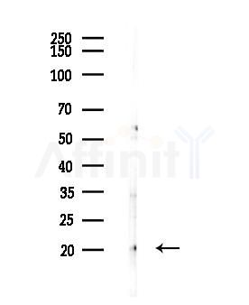 GPM6B Antibody - Western blot analysis of lysates from COLO205 cells(UV,30min treatment), using GPM6B Antibody at 1/1000 dilution.