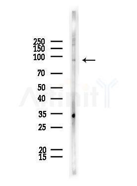 NPAS2 Antibody - Western blot analysis of lysates from HUVEC cells, using NPAS2 Antibody at 1/1000 dilution.