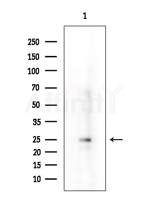 NTS Antibody - Western blot analysis of extracts from HUVEC cells, using NTS Antibody at 1/1000 dilution.