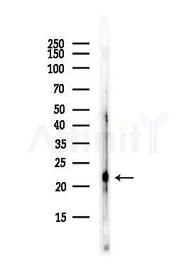 NTS Antibody - Western blot analysis of lysates from HUVEC cells, using NTS Antibody at 1/1000 dilution.
