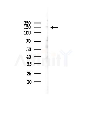 NID2 Antibody - Western blot analysis of lysates from COLO205 cells(UV,30min treatment), using NID2 Antibody at 1/1000 dilution.