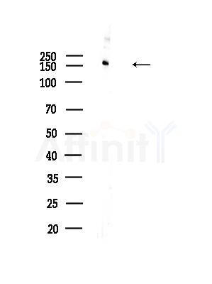 NUP155 Antibody - Western blot analysis of lysates from 3T3-L1 P6(heat-shock,45min treatment), using NUP155 Antibody at 1/1000 dilution.