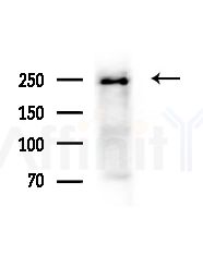 NUP205 Antibody - Western blot analysis of extracts from B16F10-HUC(heat-shock,45min treatment), using NUP205 Antibody at 1/1000 dilution.