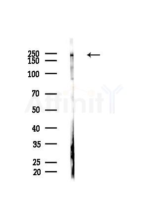 NUP205 Antibody - Western blot analysis of lysates from B16F10-HUC(heat-shock,45min treatment), using NUP205 Antibody at 1/1000 dilution.
