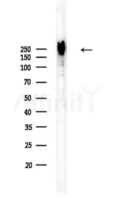 NUP214 Antibody - Western blot analysis of lysates from COLO205 cells, using NUP214 Antibody at 1/1000 dilution.
