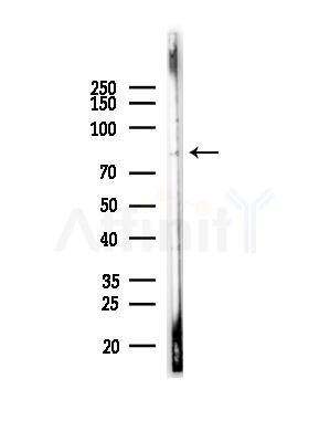 NUP88 Antibody - Western blot analysis of lysates from LoVo cells(heat-shock,45min treatment), using NUP88 Antibody at 1/1000 dilution.