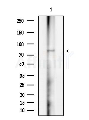 NOL11 Antibody - Western blot analysis of extracts from Rat brain, using NOL11 Antibody at 1/1000 dilution.