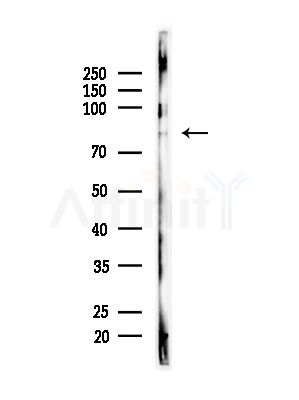 NOL11 Antibody - Western blot analysis of lysates from Rat brain, using NOL11 Antibody at 1/1000 dilution.