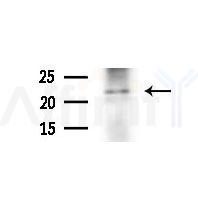 NOL12 Antibody - Western blot analysis of extracts from various samples, using NOL12 Antibody at 1/1000 dilution.