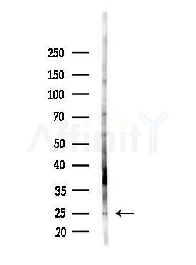 NOL12 Antibody - Western blot analysis of lysates from HepG2 cells(LPS, 4h treatment), using NOL12 Antibody at 1/1000 dilution.