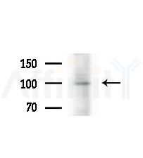 NOL14 Antibody - Western blot analysis of extracts from various samples, using NOL14 Antibody at 1/1000 dilution.