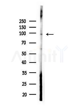 NOL14 Antibody - Western blot analysis of lysates from HepG2 cells(LPS, 4h treatment), using NOL14 Antibody at 1/1000 dilution.